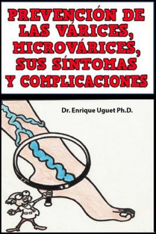 Kniha Prevencion de las Varices, Microvarices, sus sintomas y complicaciones: (Color) Dr Enrique Uguet Ph D
