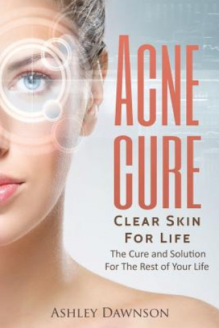 Könyv Acne Cure Clear Skin For Life Ashley Dawnson
