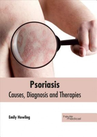 Carte Psoriasis: Causes, Diagnosis and Therapies Emily Howling