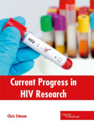 Book Current Progress in HIV Research Chris Stinson