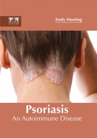 Könyv Psoriasis: An Autoimmune Disease Emily Howling