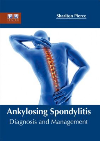 Kniha Ankylosing Spondylitis: Diagnosis and Management Sharlton Pierce