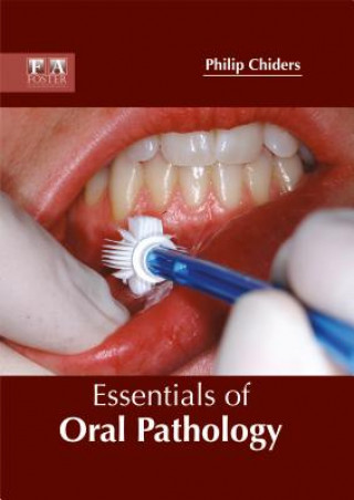 Carte Essentials of Oral Pathology Philip Chiders