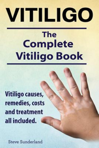Carte Vitiligo. Vitiligo causes, remedies, costs and treatment all included. The complete Vitiligo Book. Steve Sunderland