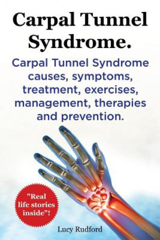 Książka Carpal Tunnel Syndrome. Carpal Tunnel Syndrome causes, symptoms, treatment, exercises, management, therapies and prevention. Real Life Stories Inside! Lucy Rudford