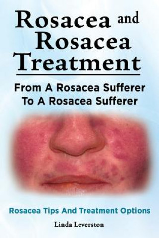 Könyv Rosacea and Rosacea Treatment. From A Rosacea Sufferer To A Rosacea Sufferer. Rosacea Tips And Treatment Options Linda Leverston