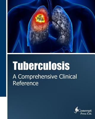 Knjiga Tuberculosis: A Comprehensive Clinical Reference Iconcept Press