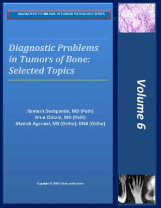 Книга Diagnostic Problems in Bone Tumors: Selected Topics Dr Ramesh B Deshpande