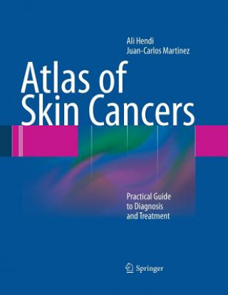 Kniha Atlas of Skin Cancers Ali Hendi