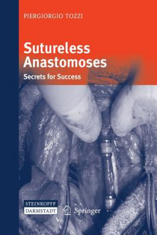 Książka Sutureless Anastomoses P Tozzi