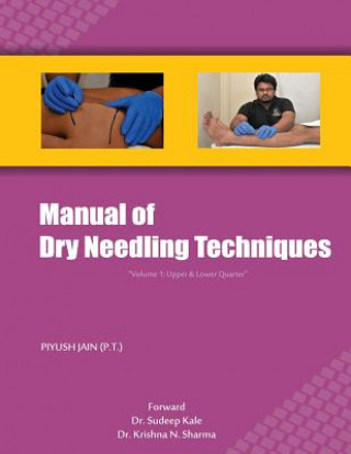 Carte Manual of Dry Needling Techniques Piyush Jain Pt