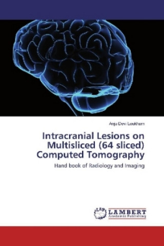 Kniha Intracranial Lesions on Multisliced (64 sliced) Computed Tomography Anju Devi Loukham