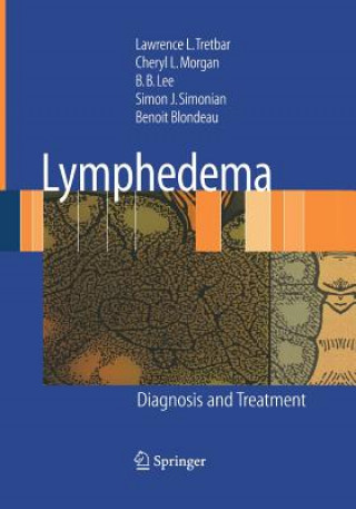 Libro Lymphedema Benoit Blondeau
