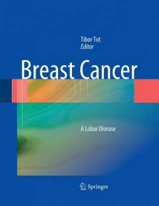 Book Breast Cancer Tibor Tot