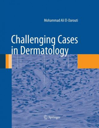 Knjiga Challenging Cases in Dermatology Mohammad Ali El-Darouti