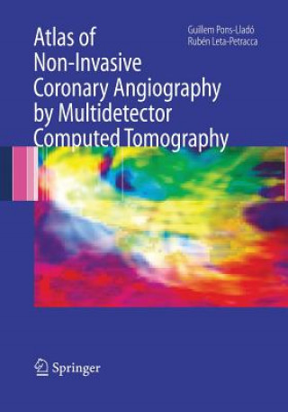 Книга Atlas of Non-Invasive Coronary Angiography by Multidetector Computed Tomography Ruben Leta-Petracca