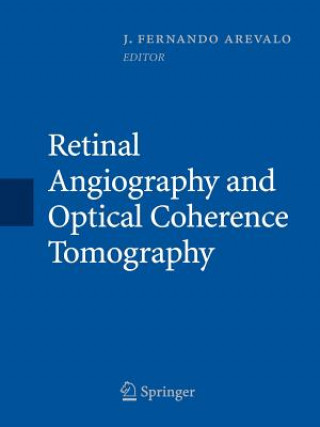 Carte Retinal Angiography and Optical Coherence Tomography J. Fernando Arévalo