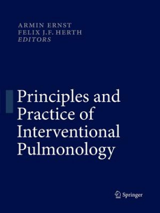 Könyv Principles and Practice of Interventional Pulmonology Armin Ernst