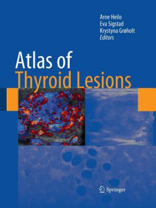 Kniha Atlas of Thyroid Lesions Krystyna Gr?holt