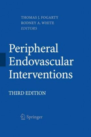 Boek Peripheral Endovascular Interventions Thomas J. Fogarty