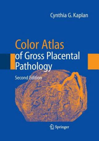 Książka Color Atlas of Gross Placental Pathology Cynthia G. Kaplan