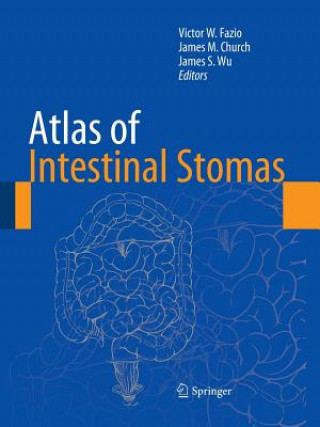 Carte Atlas of Intestinal Stomas James M. Church