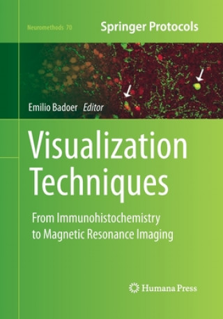 Kniha Visualization Techniques Emilio Badoer