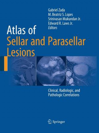 Buch Atlas of Sellar and Parasellar Lesions Edward R. Laws Jr.