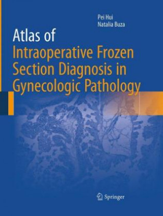 Книга Atlas of Intraoperative Frozen Section Diagnosis in Gynecologic Pathology Natalia Buza