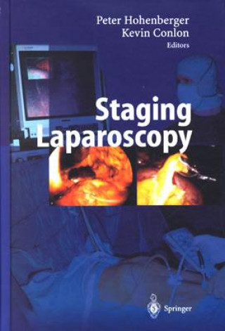 Knjiga Staging Laparoscopy K. Conlon
