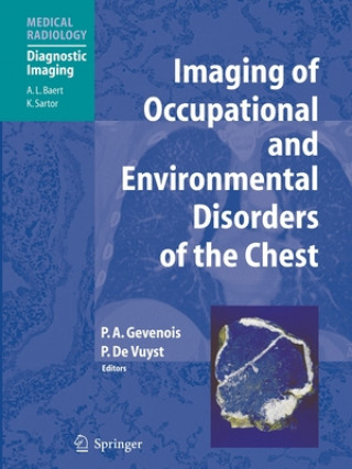 Kniha Imaging of Occupational and Environmental Disorders of the Chest Pierre Alain Gevenois