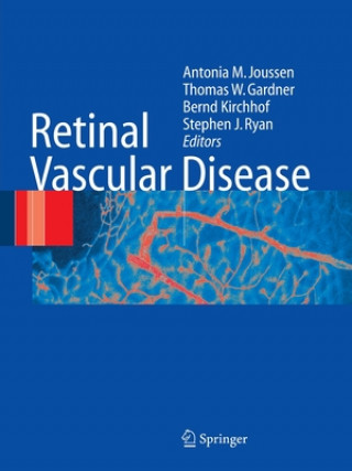 Knjiga Retinal Vascular Disease T. W. Gardner