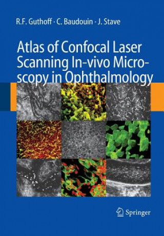 Książka Atlas of Confocal Laser Scanning In-vivo Microscopy in Ophthalmology C. Baudouin