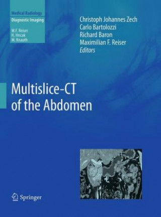 Könyv Multislice-CT of the Abdomen Richard Baron