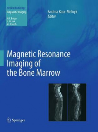 Kniha Magnetic Resonance Imaging of the Bone Marrow Andrea Baur-Melnyk