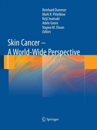 Carte Skin Cancer - A World-Wide Perspective Reinhard Dummer