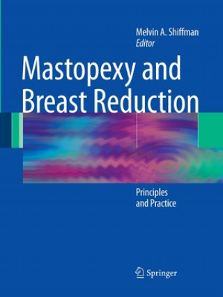 Kniha Mastopexy and Breast Reduction Melvin A. Shiffman