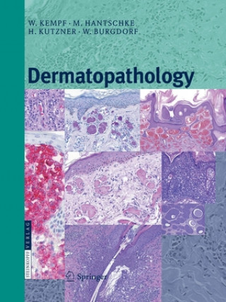 Книга Dermatopathology Walter H. C. Burgdorf