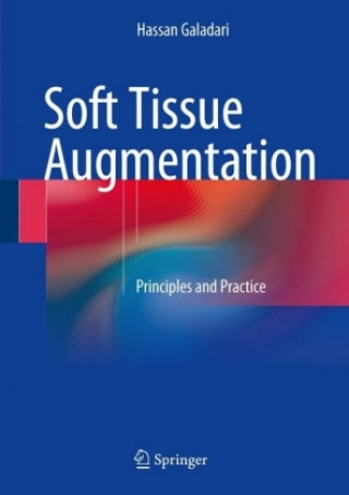 Kniha Soft Tissue Augmentation Hassan Galadari