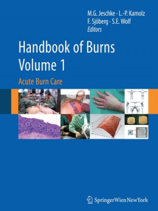 Carte Handbook of Burns Volume 1 Marc G. Jeschke