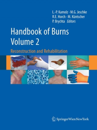 Książka Handbook of Burns Volume 2 Pavel Brychta