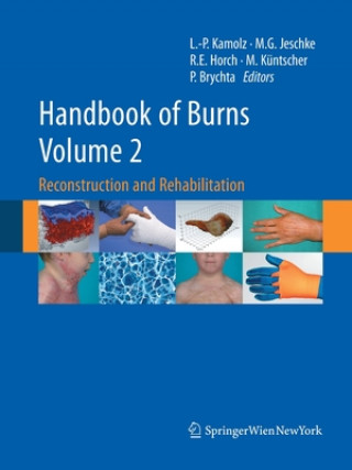 Carte Handbook of Burns Volume 2 Pavel Brychta