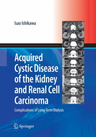 Книга Acquired Cystic Disease of the Kidney and Renal Cell Carcinoma Isao Ishikawa