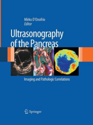 Książka Ultrasonography of the Pancreas Mirko D'Onofrio