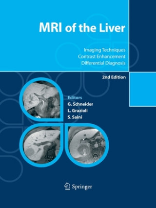 Kniha MRI of the Liver Luigi Grazioli