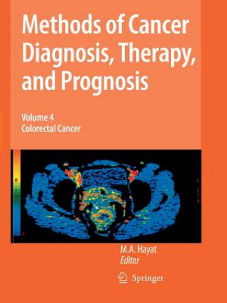 Książka Methods of Cancer Diagnosis, Therapy and Prognosis M. A. Hayat