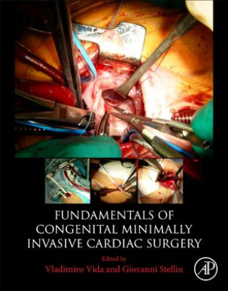 Книга Fundamentals of Congenital Minimally Invasive Cardiac Surgery Vladimiro Vida