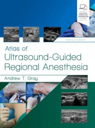 Книга Atlas of Ultrasound-Guided Regional Anesthesia Andrew T. Gray