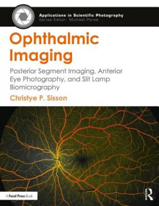 Könyv Ophthalmic Imaging SISSON