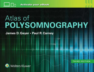 Kniha Atlas of Polysomnography James D. Geyer